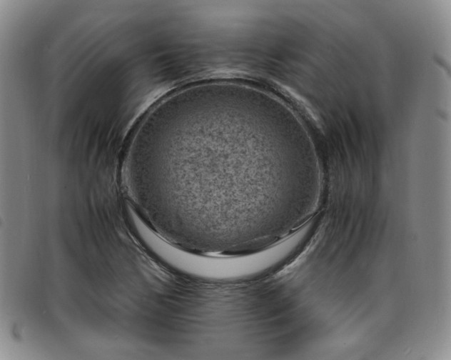 X0000098161170200804241757