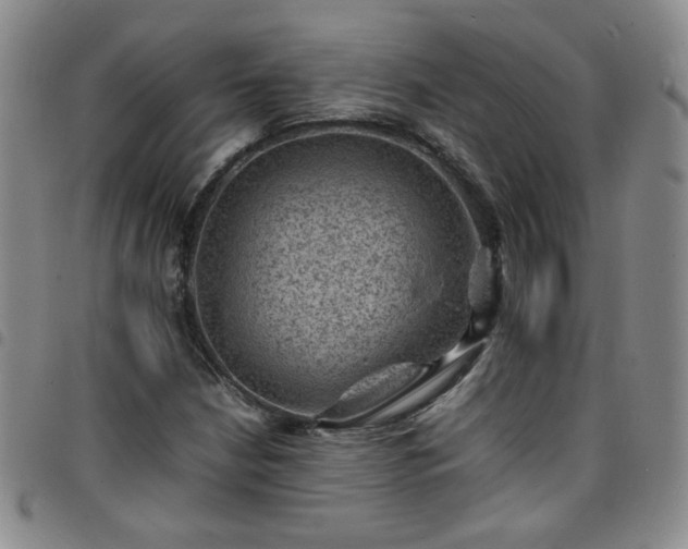 X0000098161210200804241756