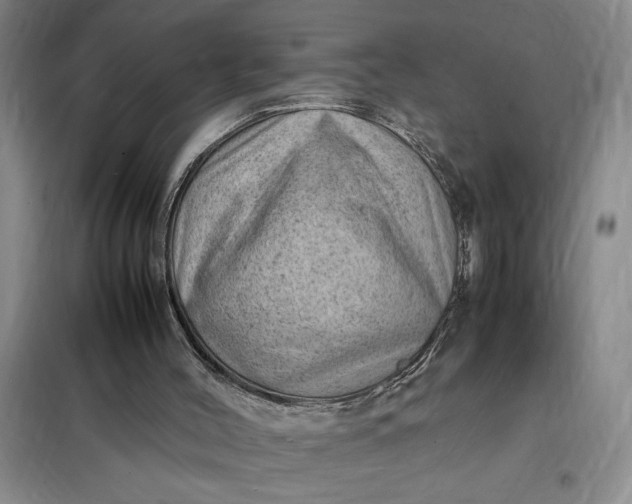 X0000098160004200805011441