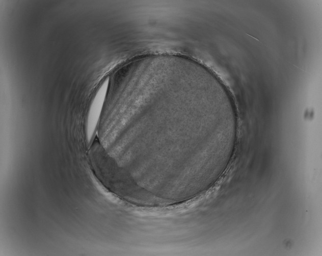 X0000098160009200805011441