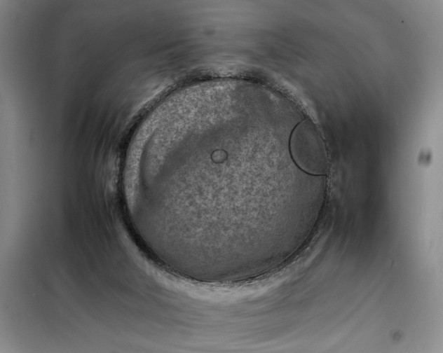 X0000098160018200805011441