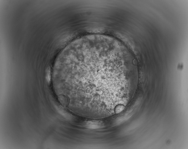 X0000098160069200805011440