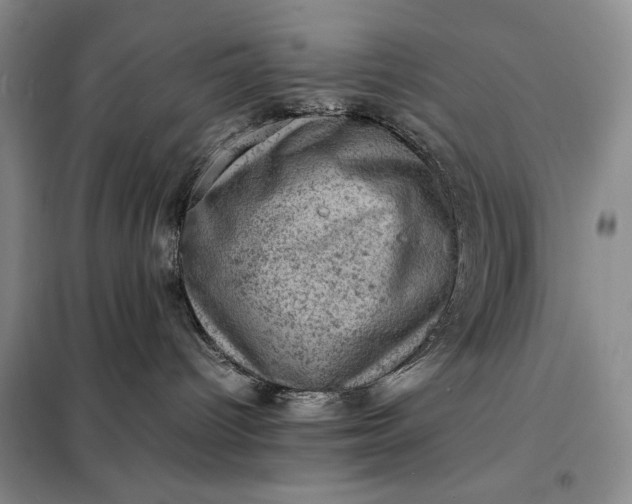 X0000098160096200805011441