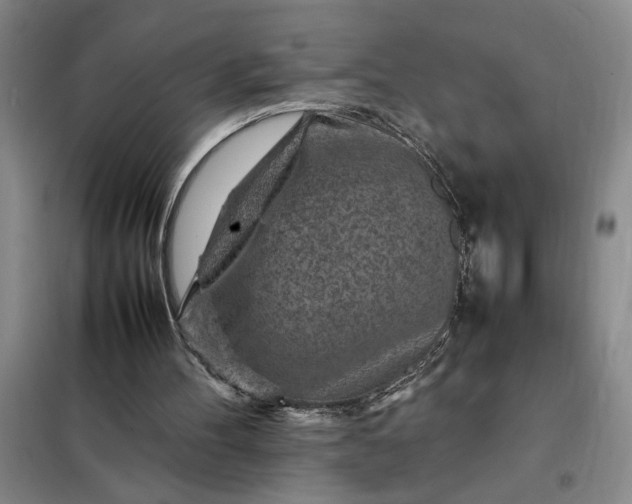 X0000098160100200805011440