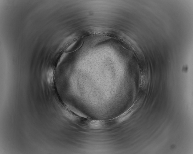 X0000098160142200805011439