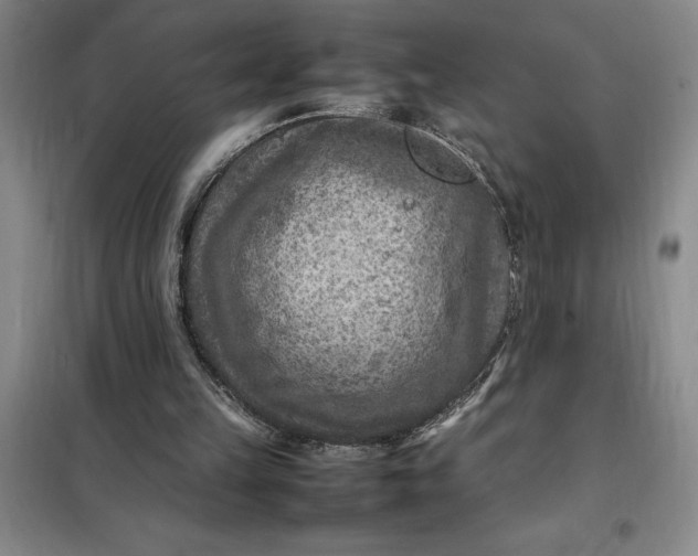 X0000098160149200805011439