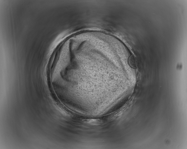 X0000098160151200805011439