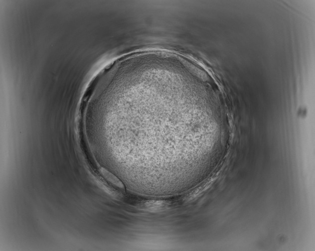 X0000098160152200805011439