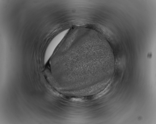 X0000098160170200805011439