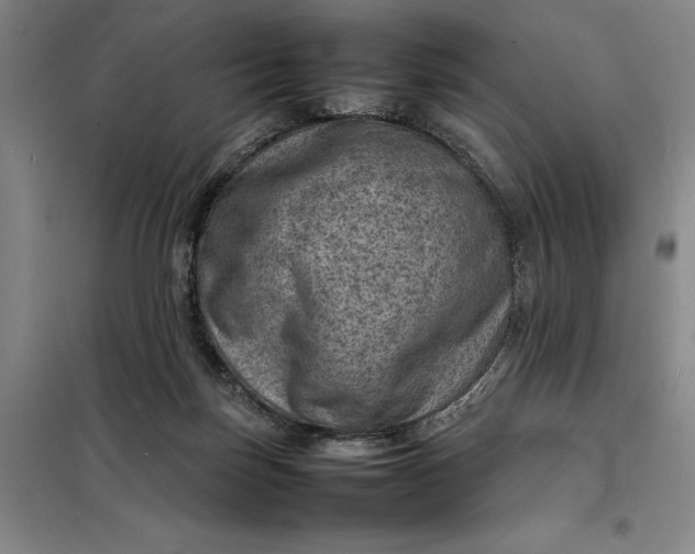 X0000098160171200805011439
