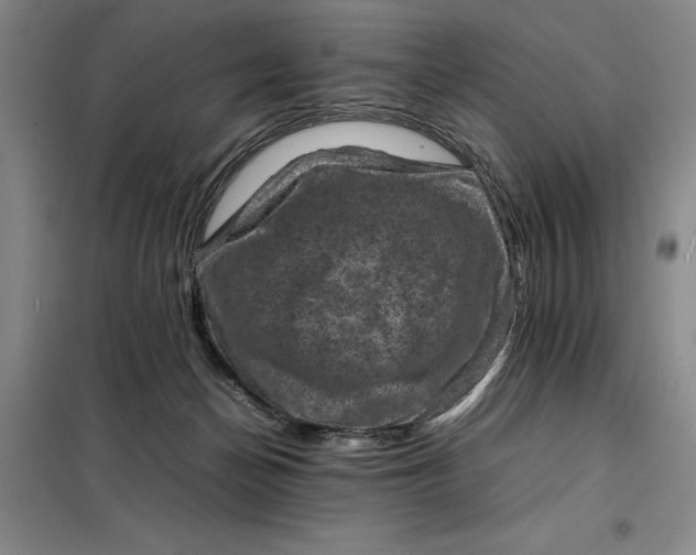 X0000098160174200805011439