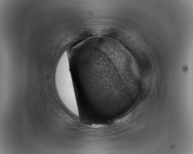 X0000098160219200805011438