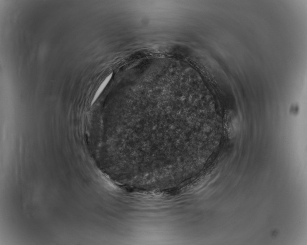 X0000098160235200805011438