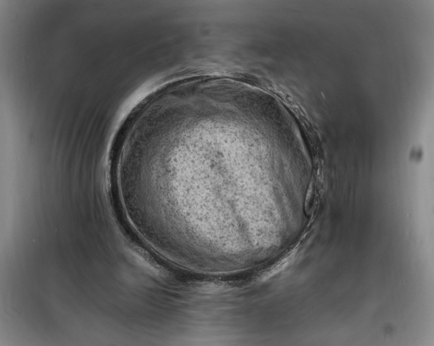 X0000098160246200805011437