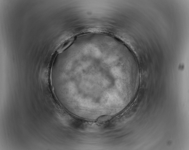 X0000098160297200805011437