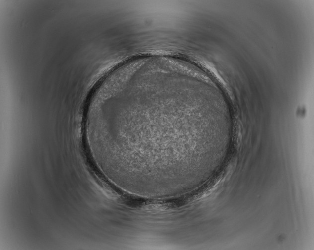 X0000098160299200805011437