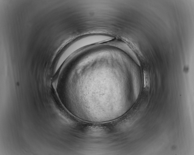 X0000098160300200805011437