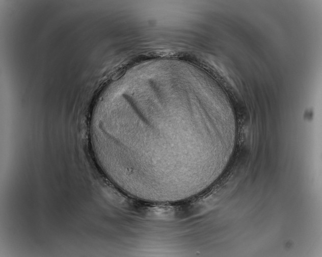 X0000098160317200805011437