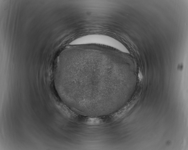 X0000098160376200805011436