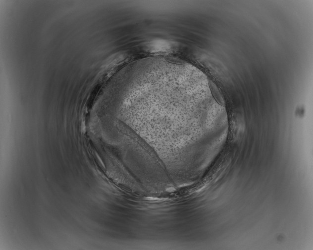 X0000098160379200805011436