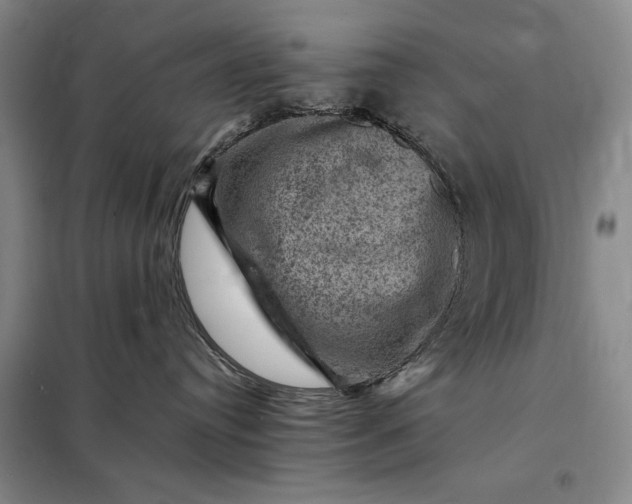 X0000098160384200805011436