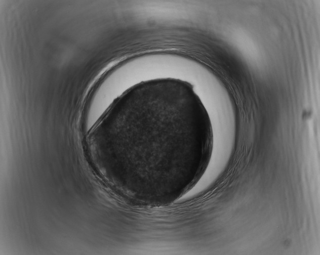X0000098160387200805011436
