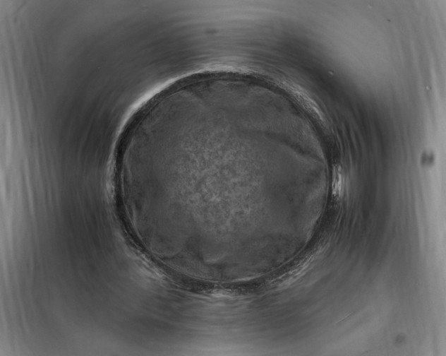 X0000098160388200805011436