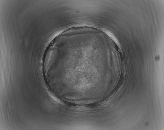 X0000098160389200805011436