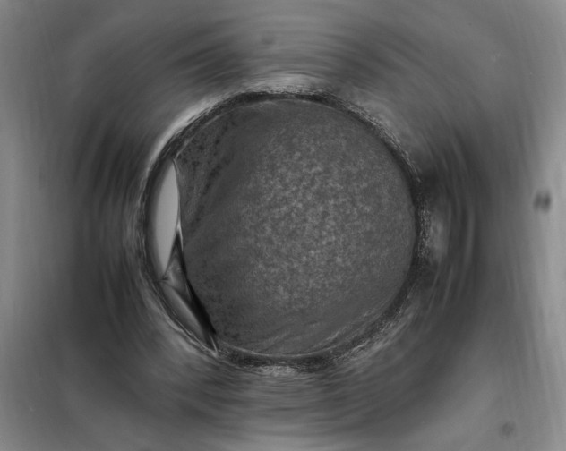 X0000098160392200805011436