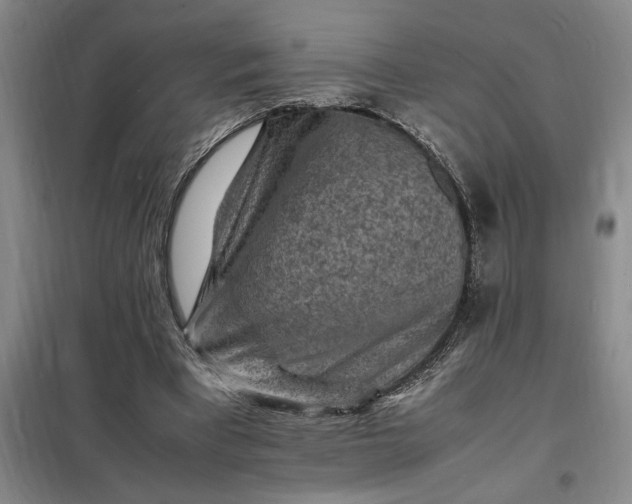 X0000098160393200805011436