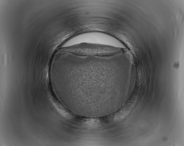 X0000098160398200805011436