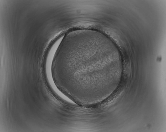 X0000098160399200805011436