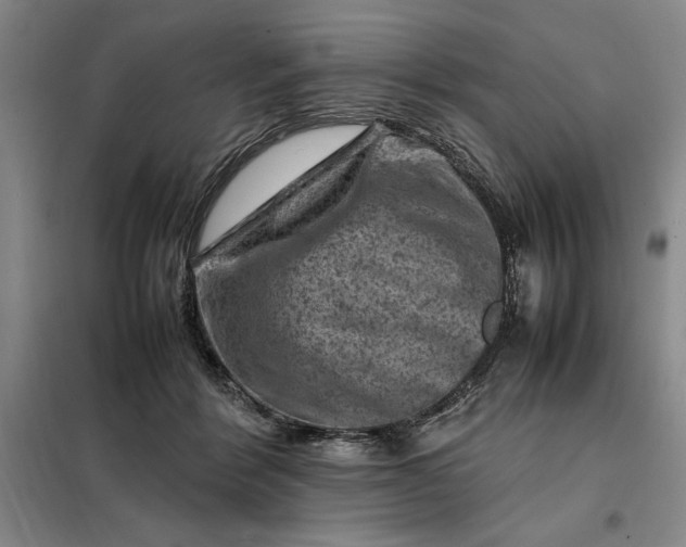 X0000098160412200805011435