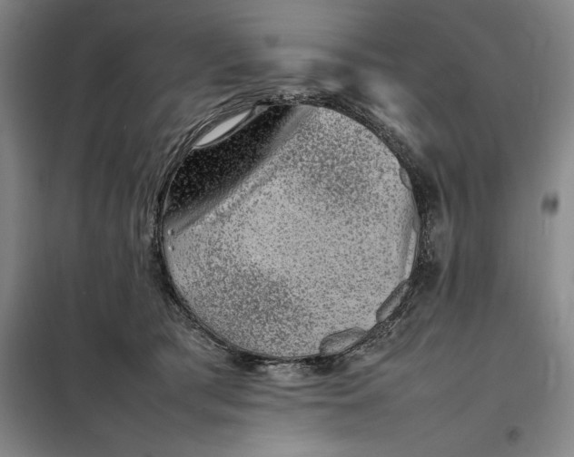 X0000098160417200805011435
