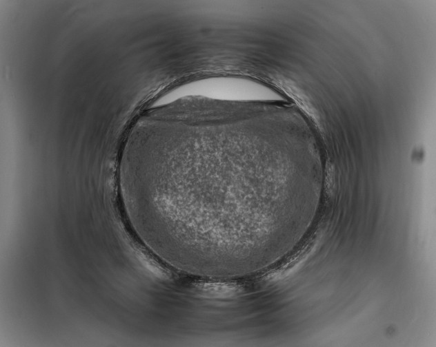 X0000098160449200805011434