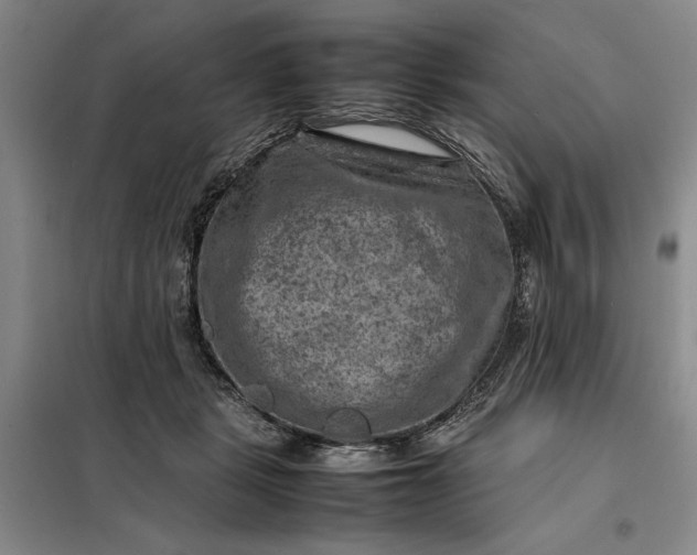 X0000098160461200805011435