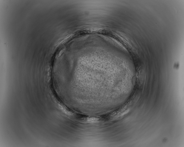 X0000098160462200805011435