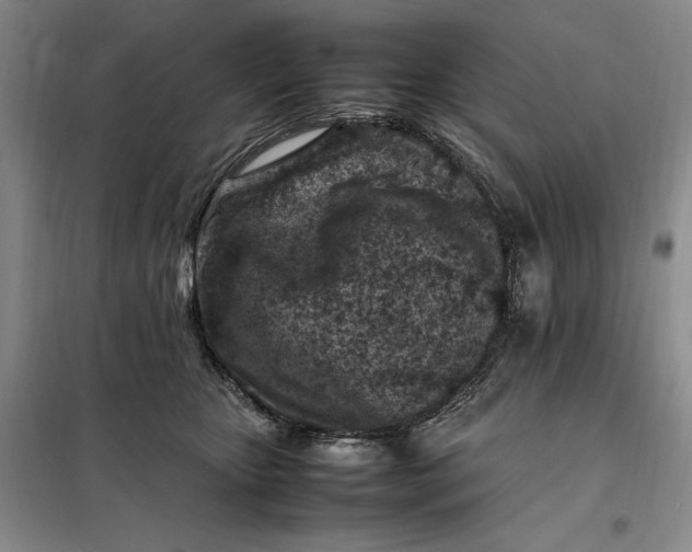 X0000098160467200805011435