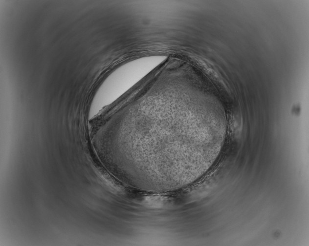 X0000098160470200805011435