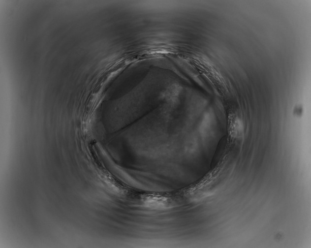 X0000098160471200805011435