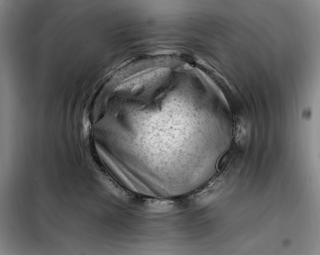 X0000098160476200805011435