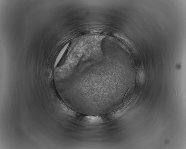 X0000098160477200805011435