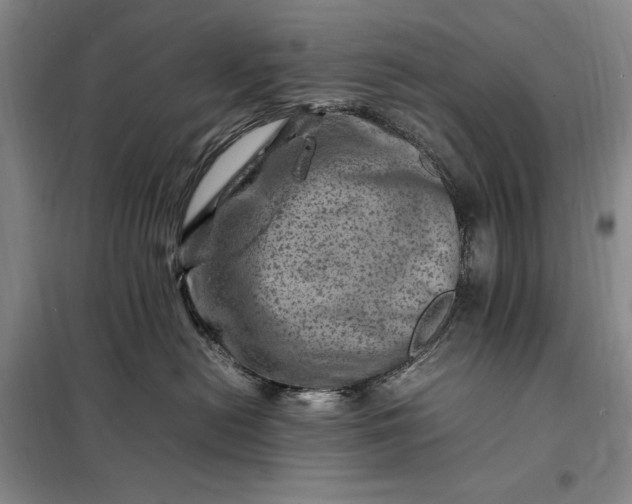 X0000098160478200805011435