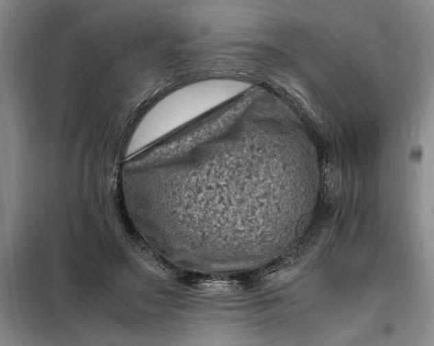 X0000098160499200805011434