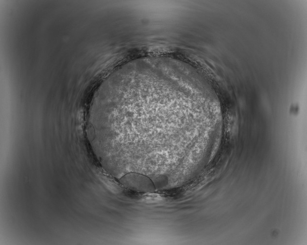 X0000098160519200805011434