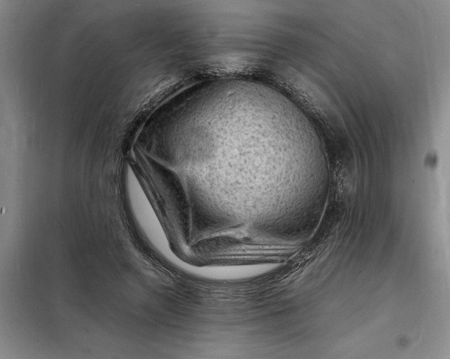 X0000098160546200805011433