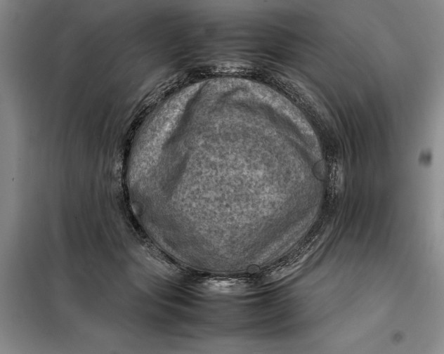 X0000098160557200805011433