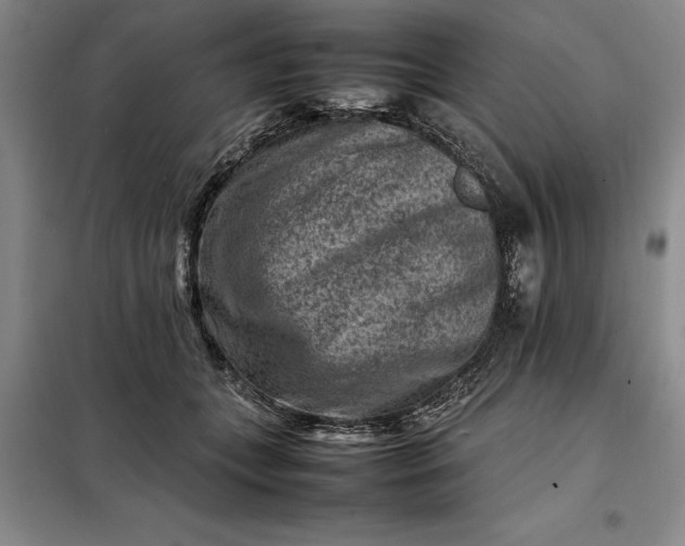 X0000098160559200805011433