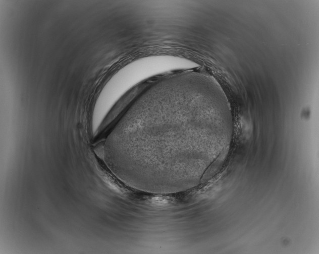 X0000098160566200805011433
