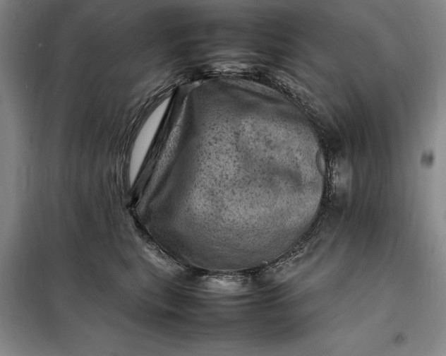 X0000098160567200805011433